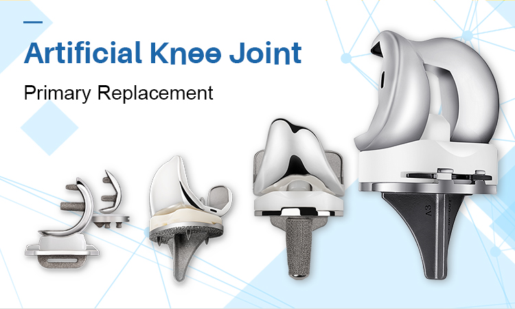 TKA for knee osteoarthritis: The Latest Progress In 7 Key Perioperative Issues